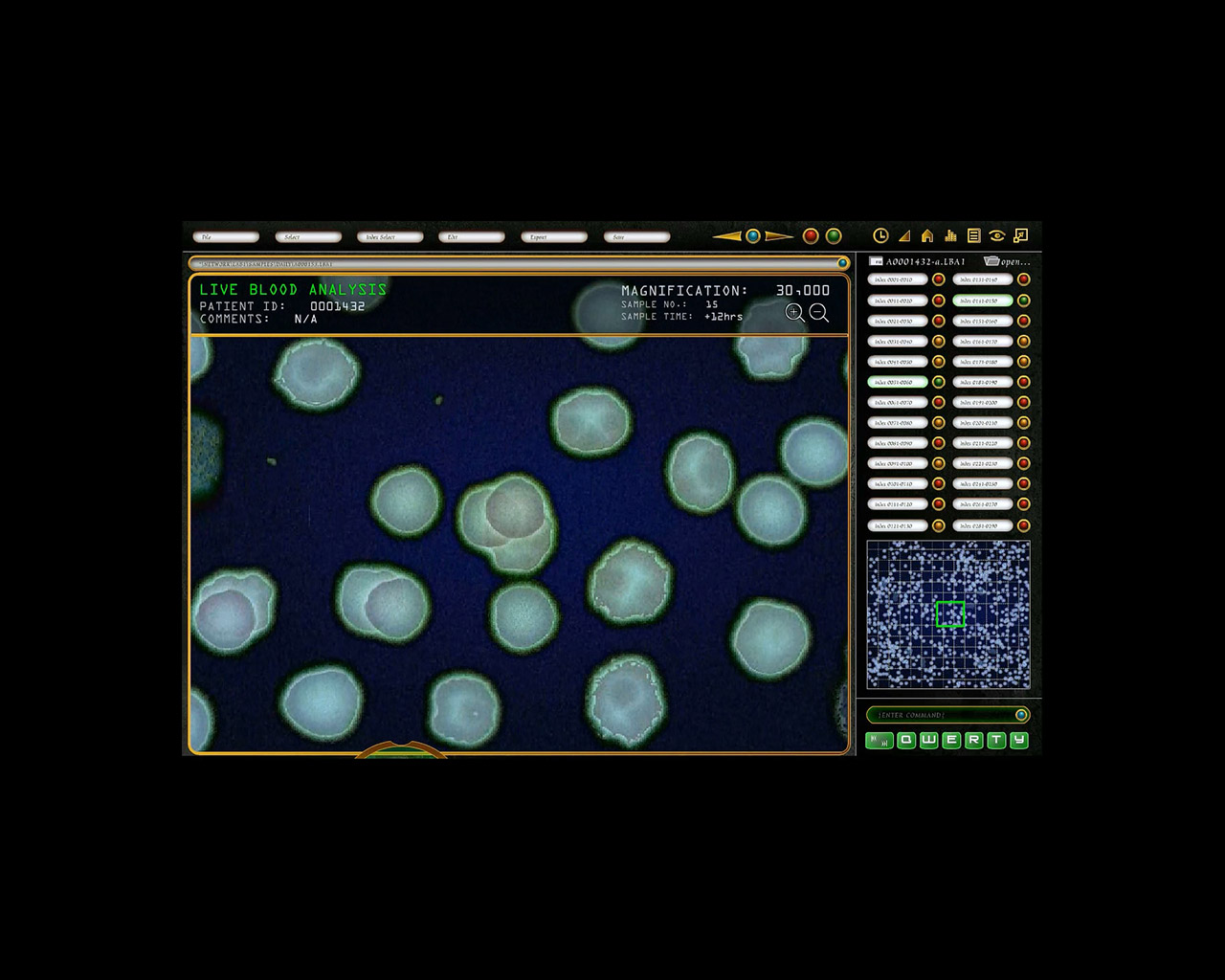 Blood Analysis